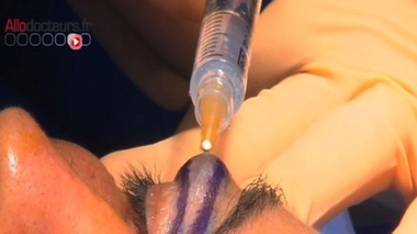 L'esthétique des yeux