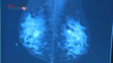Cancer du sein : un partenariat pour une meilleure prise en charge