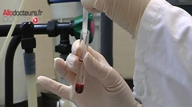 Cancer du pancréas : les faux espoirs d'un test de dépistage inventé par un jeune Américain