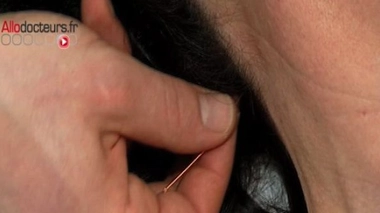 Thérapies complémentaires : l'Académie de médecine exprime ses ''réserves''