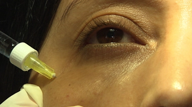 Esthétique des yeux : comment embellir son regard ?