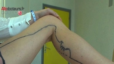 L'embolie pulmonaire