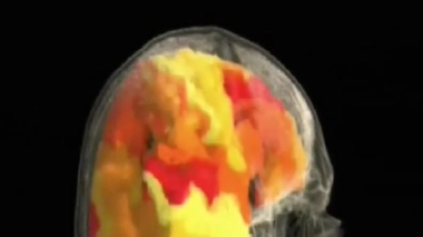 Le désir sexuel au coeur du cerveau