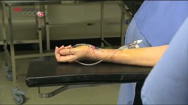 Attention, images de chirurgie ! La chimiothérapie hyperthermique intrapéritonéale combine chirurgie et bain de chimiothérapie.