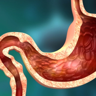 Acidité, brûlures, crampes... quand l'estomac fait mal