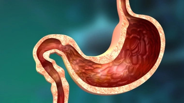 Acidité, brûlures, crampes... quand l'estomac fait mal