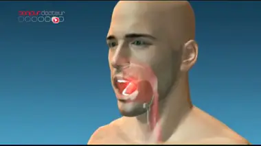 Les dégâts de l'alcool