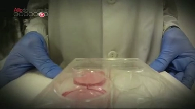 Premières cellules souches humaines obtenues par clonage