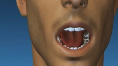 La bouche est la porte d'entrée de nombreuses bactéries 