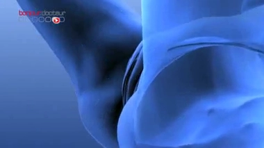 L'hystérectomie : l'ablation de l'utérus