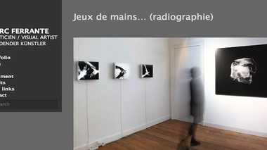 Rayons X : l'ASN rappelle à l'ordre un artiste