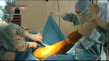 Des sondes échographiques sources de contaminations