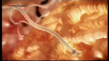 Reportage de Géraldine Zamansky et Maxime Vautier.